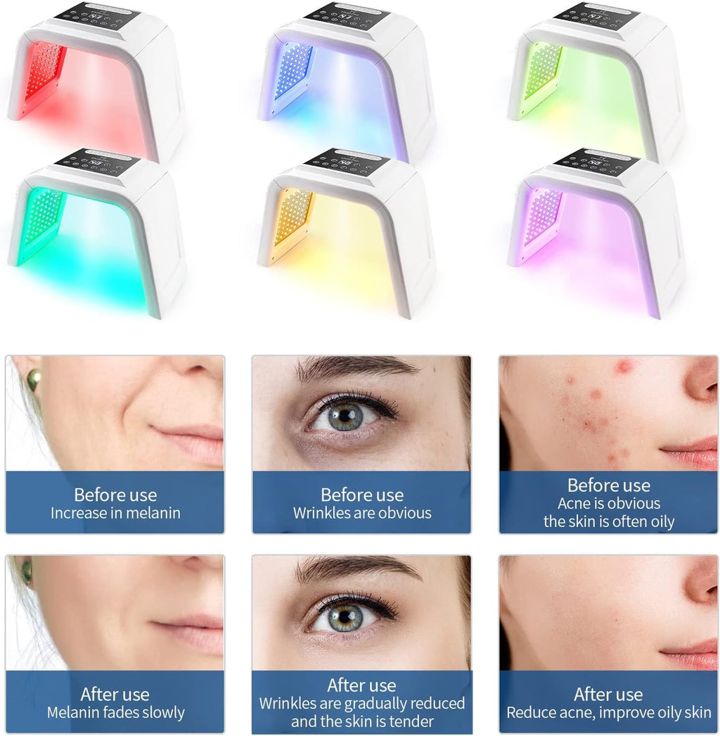 Red Light Therapy Lamp with Nano Spray,6 Colors Led Light Therapy Mask,Pdt Machine,Led Face Light Therapy Mask,178Pcs Leds, UK Plug, Anti-Anging,Rejuvenation,Firming,Smooth Wrinkle,Skin Brighten,White
